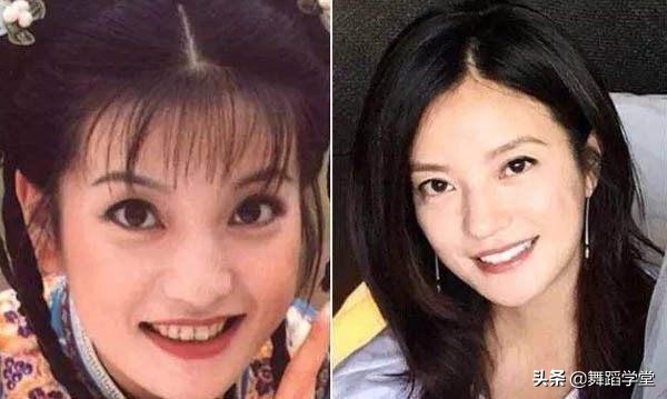 每天刷牙为啥牙齿还那么黄？坚持用它黄牙变白牙，嘴里清新没异味