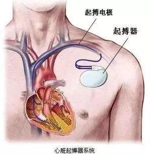 ʧ߷иСӡǾ
