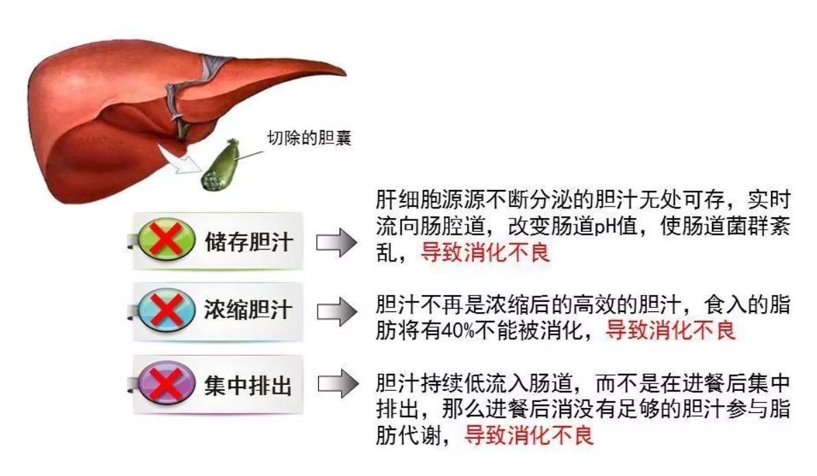 胆囊切除后饮食应该注意哪些 珠江医院肝胆曾大夫 Mdeditor