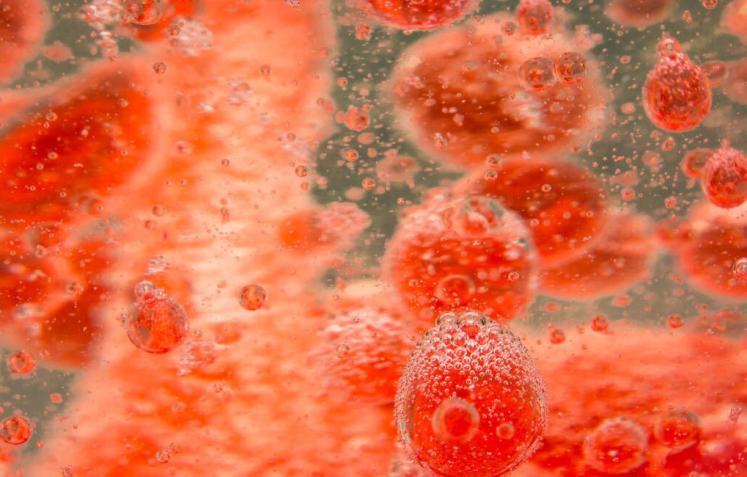 寒冷天氣襲來，血脂高的人特別要注意3件事，謹防心腦血管疾病