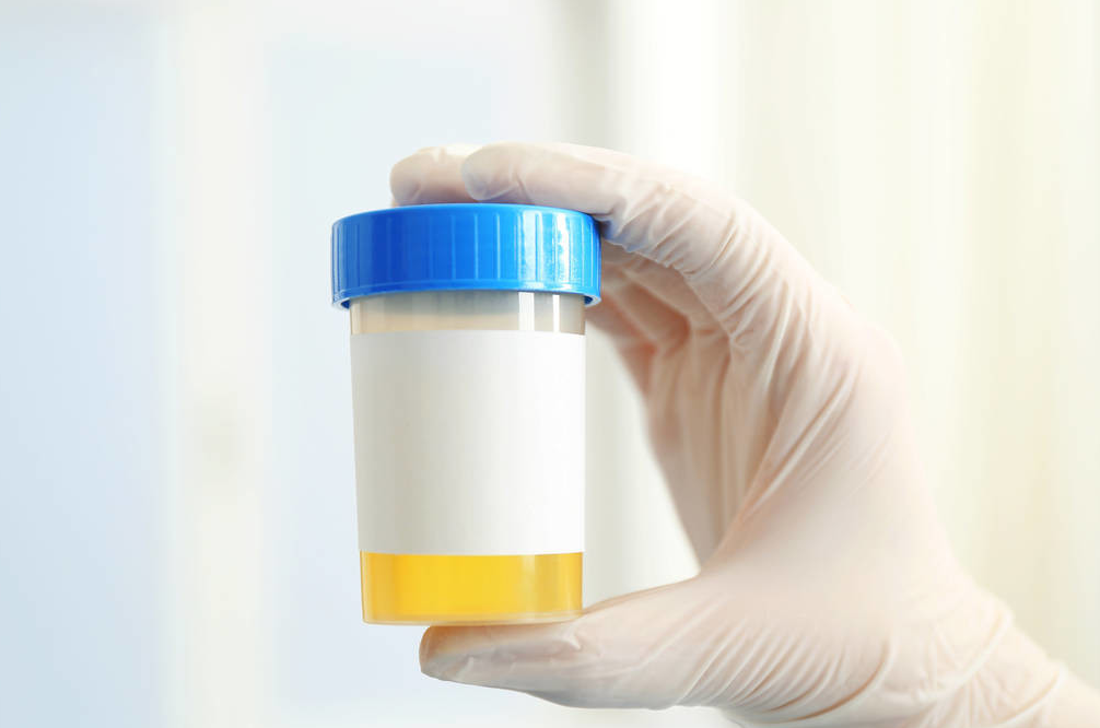 一喝水就想上廁所的人，說明腎功能出現問題？ 這些原因你該知道