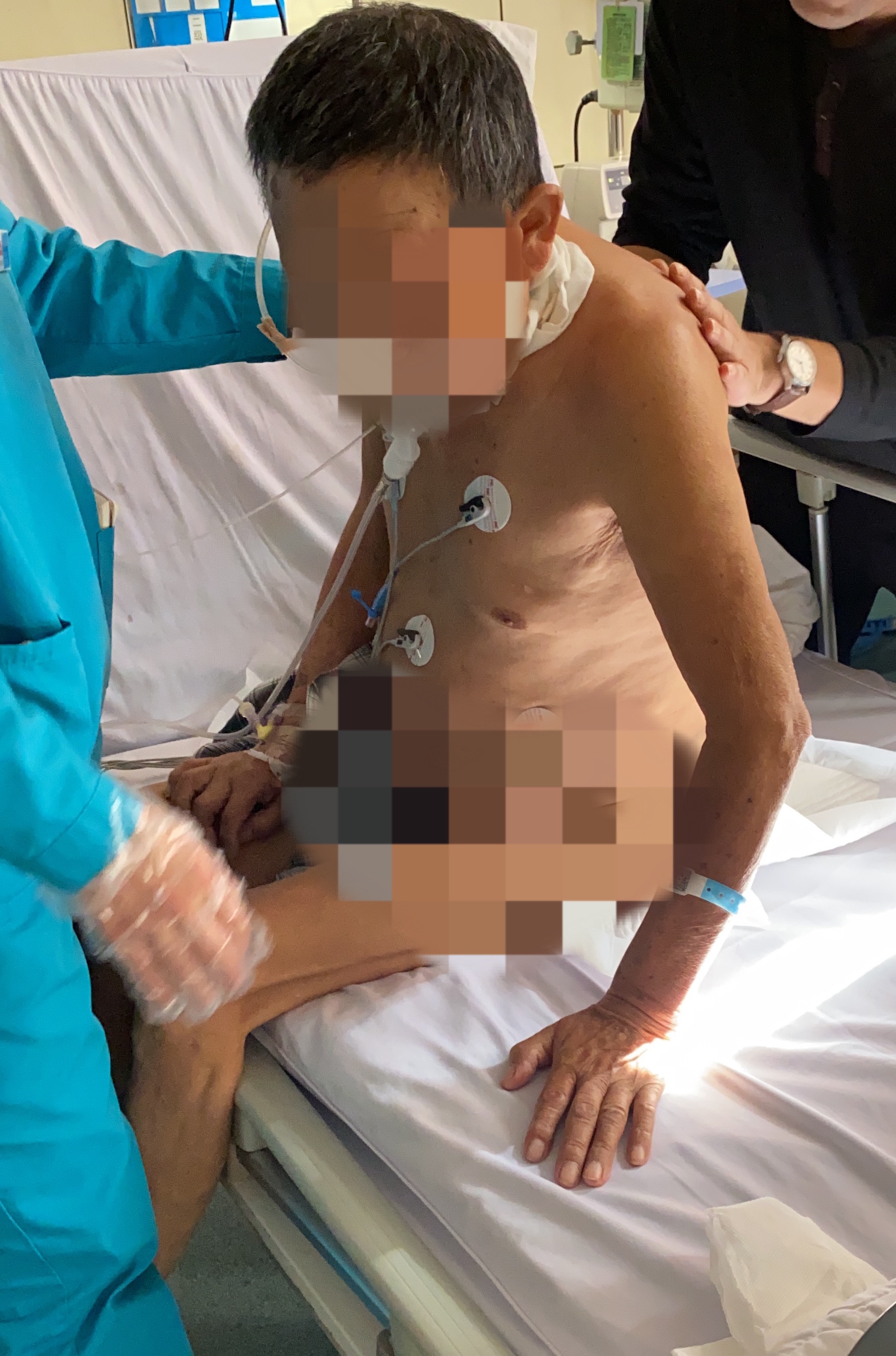 脑梗死、脑出血后的误区！一定要帮亲人朋友收藏#慢病防治知识#