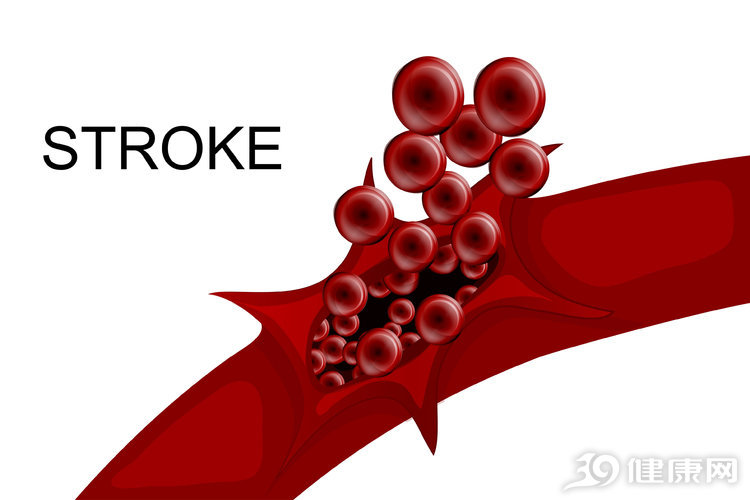 高血壓患者3種食物長期吃，可以改善血管硬化，血管暢通血壓降