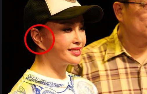 脸僵如石！明知“硅胶脸”恐怖，为何还有女星