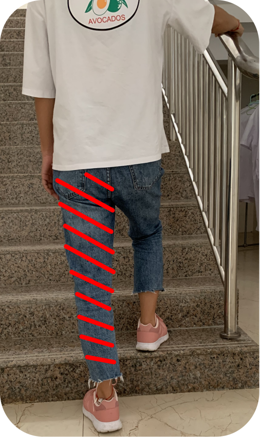 髋关节置换术后必须知道的那些事  #健康科普大赛#