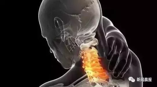 颈椎不能随便按摩，如此惨痛教训放射科见得太多了