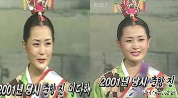 大方承認整容，卻依舊被奉為女神的5位女星