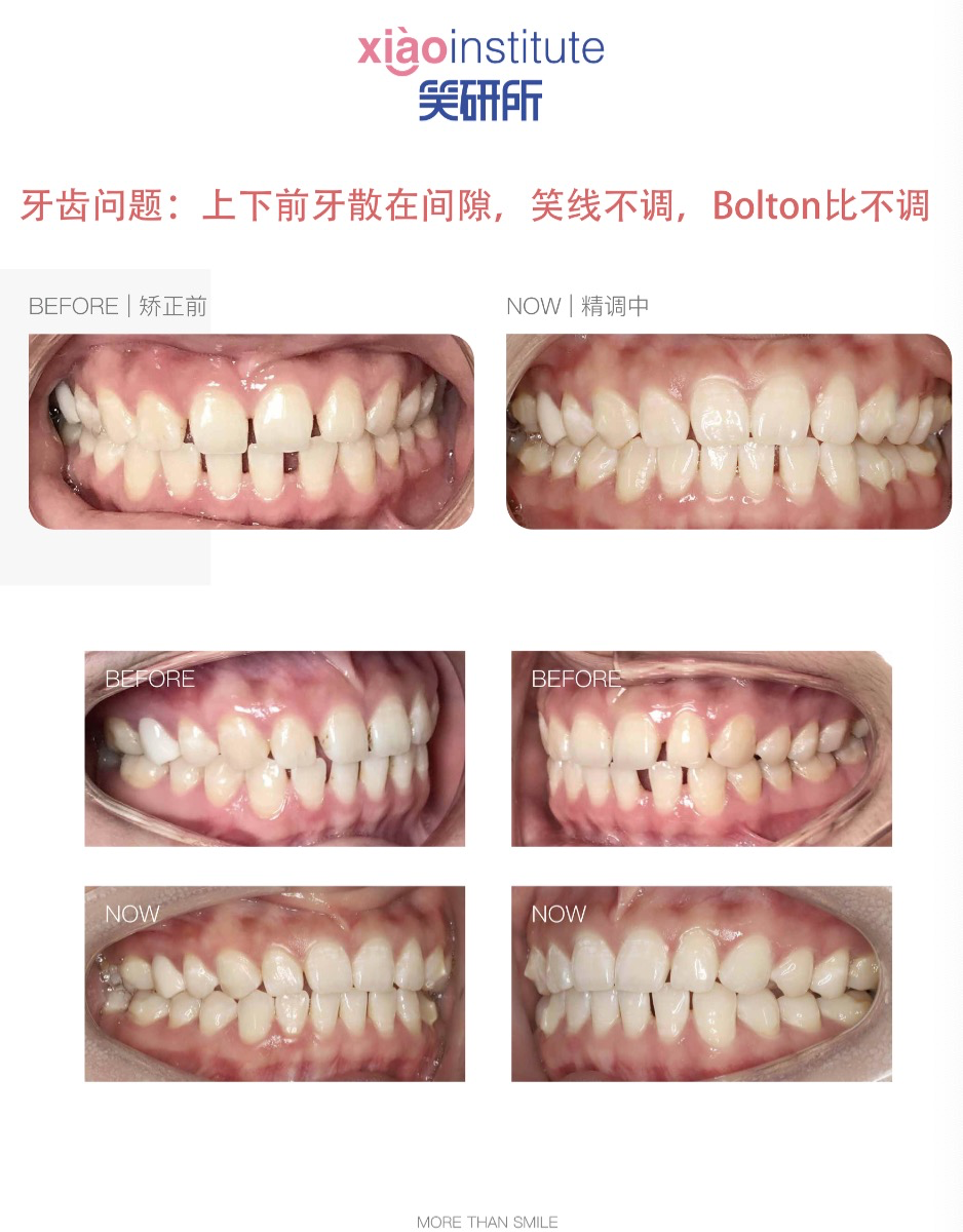 ������������ع⣺������������˵��۹����ں��ˣ���