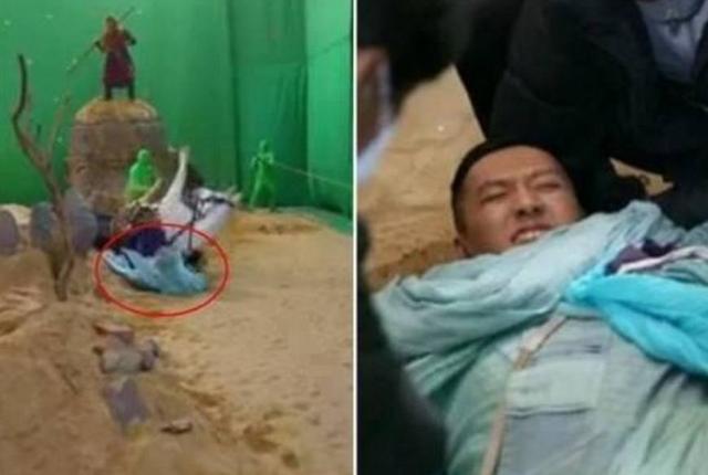 63岁潘长江出意外受重伤！粉碎性骨折伤势严重，