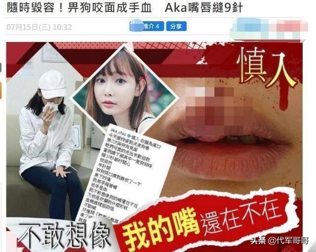 又一位32岁女星被狗咬伤！嘴唇缝9针险毁容，网友：看到都感觉疼