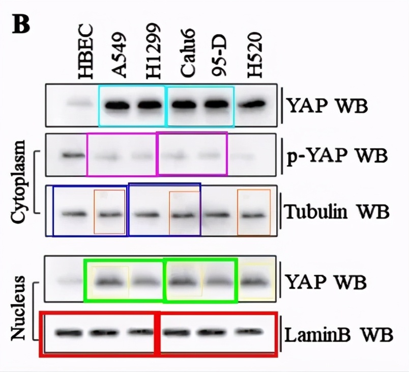 山东滨州医学院附属医院11篇SCI文章"挂榜"PubPeer