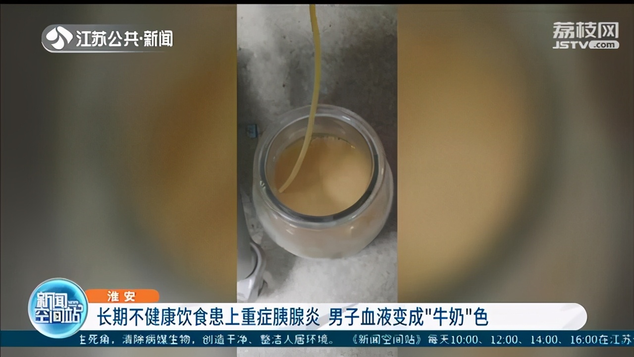 引以为戒！长期饮食不健康患胰腺炎七次住院 男子血液还成“牛奶”色