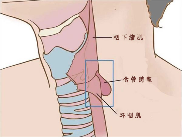 为什么会口臭？口臭能预防和治疗吗？