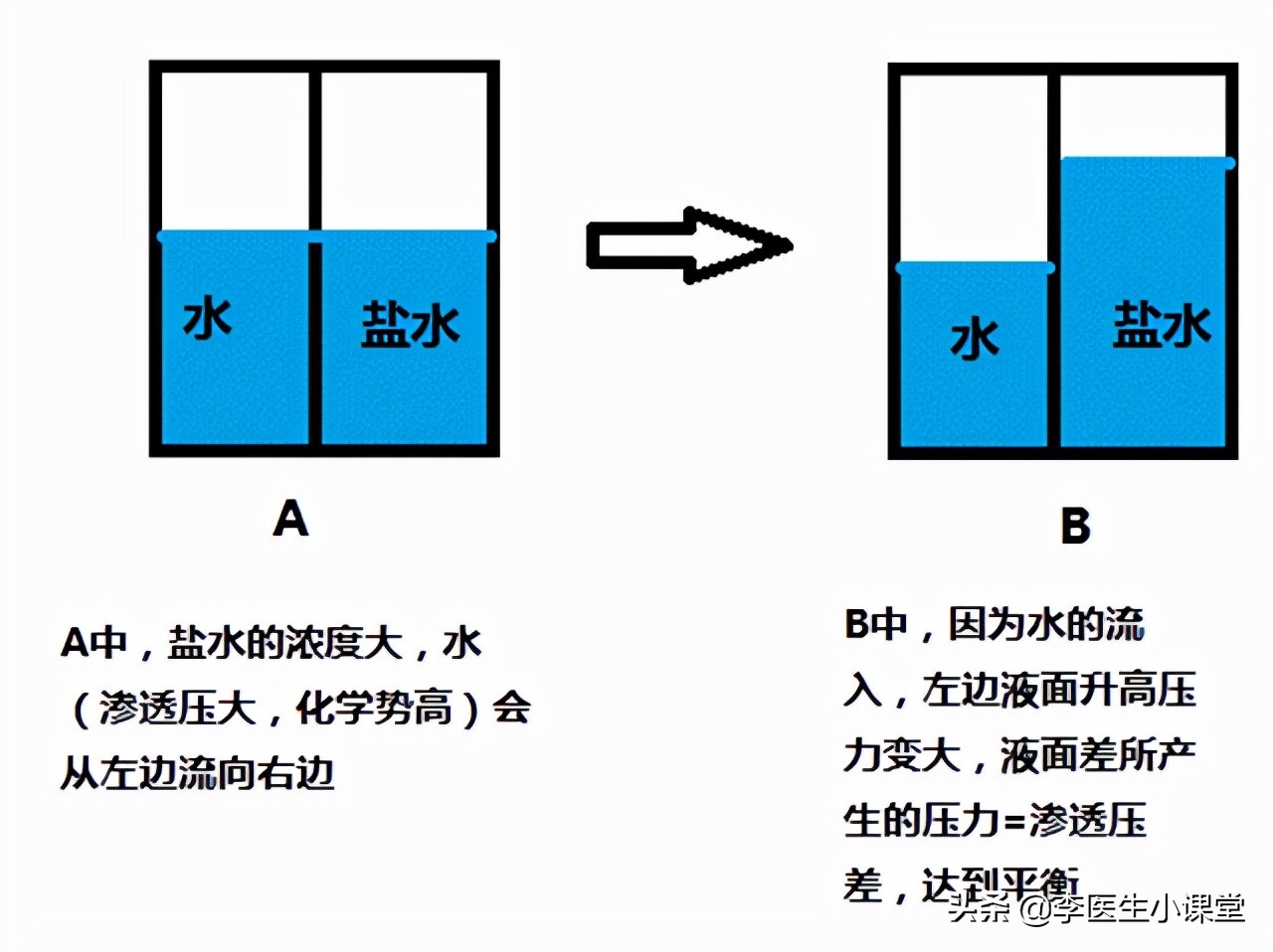 肾功能受损有哪些征兆？医生：除了泡沫尿，这几种症状也要警惕