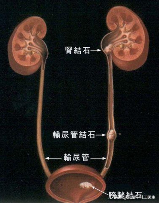 坦索罗辛除了改善尿频，还能治疗良性前列腺增生、早泄等男科疾病