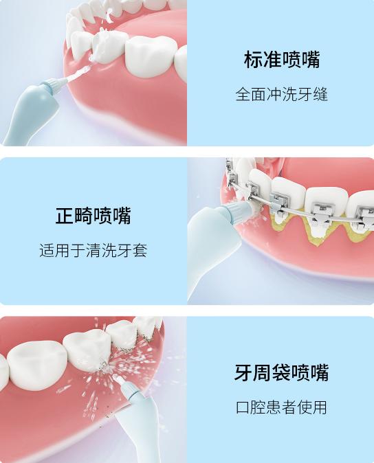 小米有品上架可视冲牙器 内置500万像素摄像头