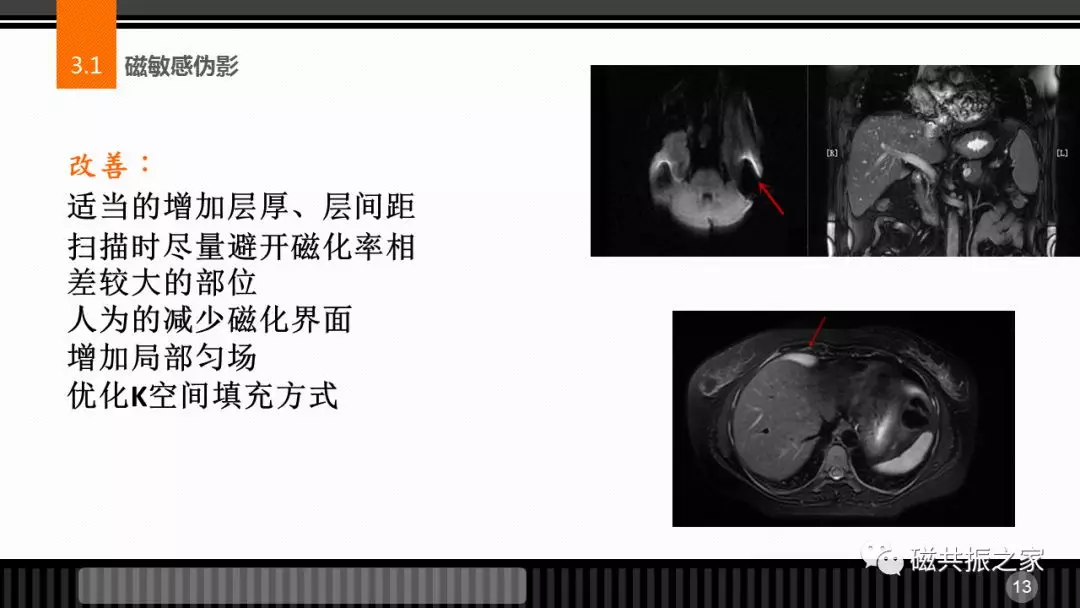 磁共振常见伪影及策略