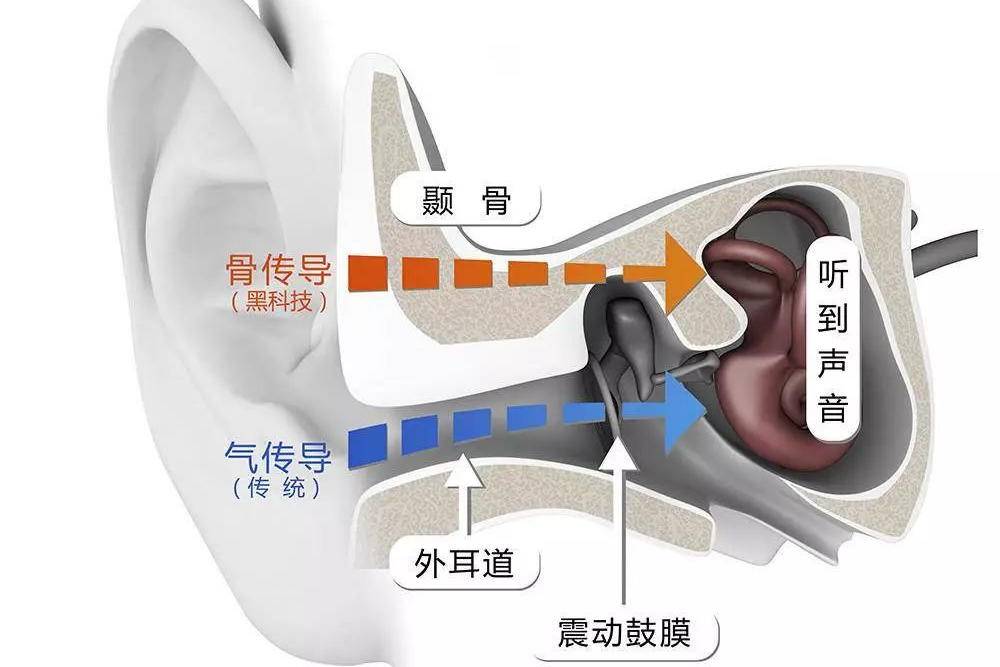 解放双耳，抛开手机，南卡Runner Pro骨传导耳机体验