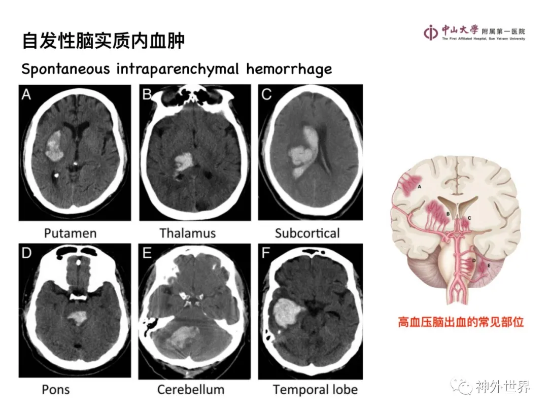 最全影像总结 | 颅内病变 MR、CT 的阅片技巧，太赞了