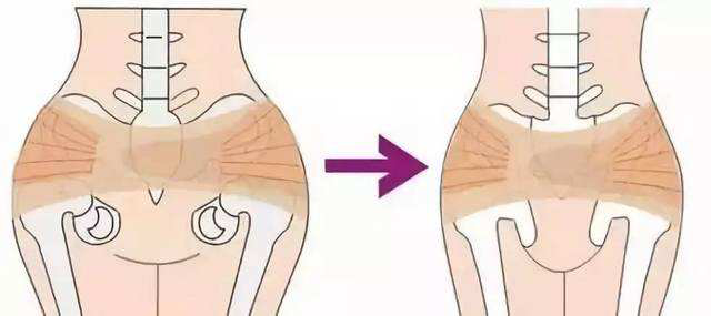 有假胯穿裤子不好看，这几点是造成假胯宽的元凶，你要知道