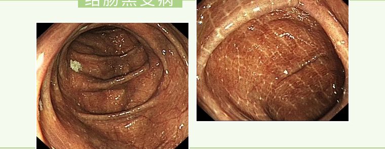 你今天大便了吗？