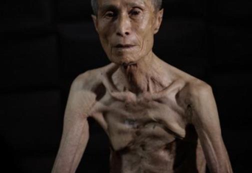 为何日本人忌惮谈起二战？核爆炸亲历者现状，