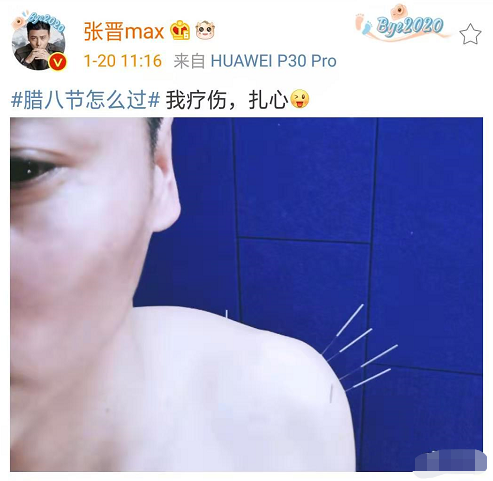 張晉蔡少芬臘八節做針灸，娘娘為保凍顏滿臉扎針，三個兒女齊出鏡