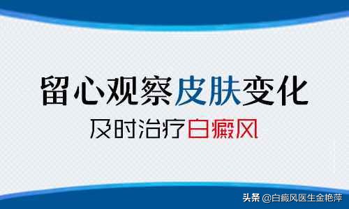 白癜风无扩散无增多、可以不用治、真的是这样么？