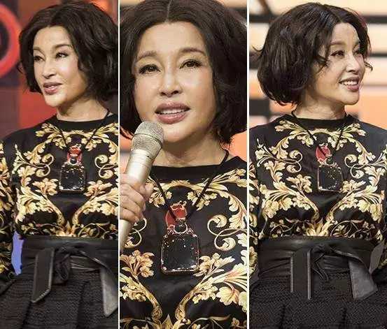 整容失败的10位明星，谁堪称“阴影”之最？