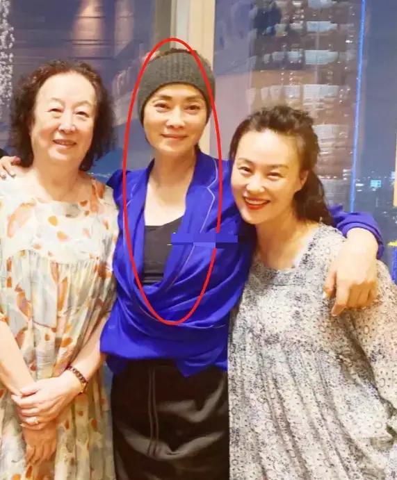 毛阿敏暴瘦苍老近照流出，眼窝深陷素颜难掩沧桑