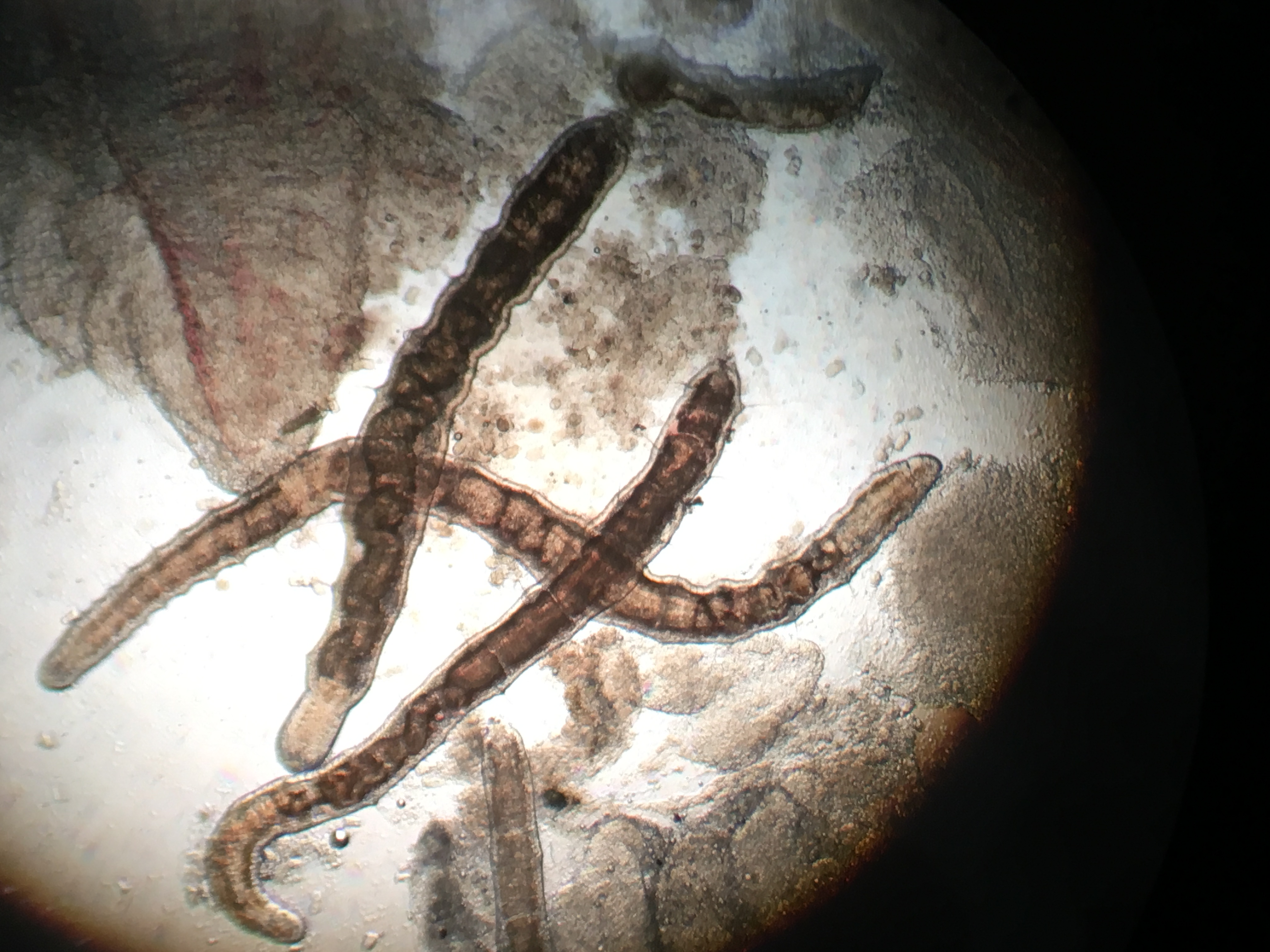 分析和管理池底