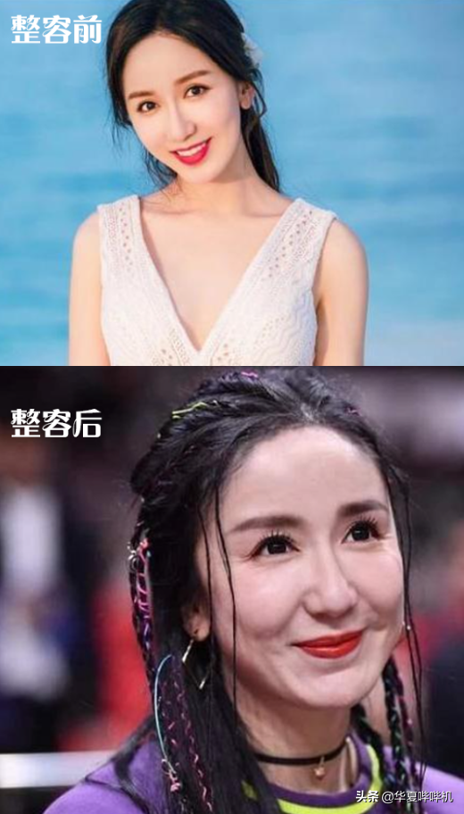 明星大型“翻车”现场，她们是如何整容变毁容