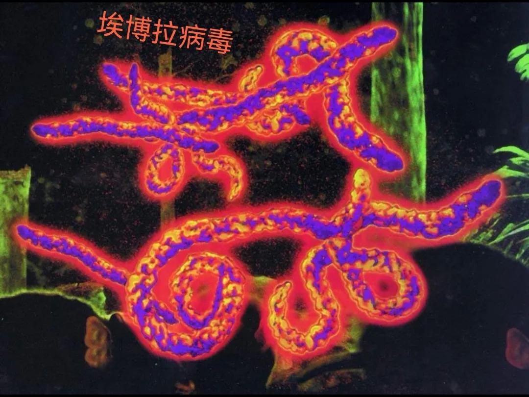 全球历史几大瘟疫死亡人数