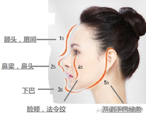 你为什么后悔做脂肪填充？