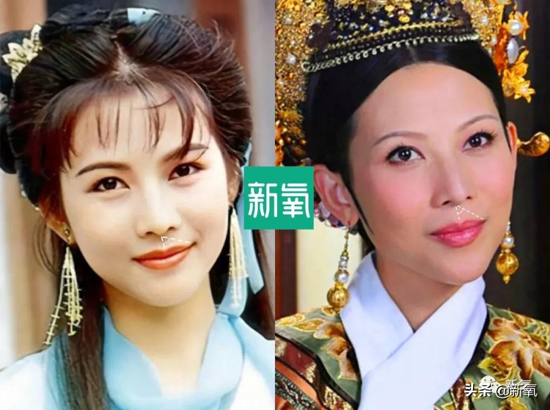 为什么蔡少芬身上的美人感逐渐消失了?