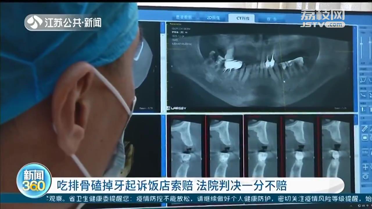 南京女子吃排骨磕掉牙，起诉饭店索赔5千 法院判决一分不赔