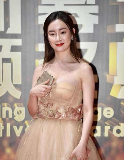 脸僵如石！明知“硅胶脸”恐怖，为何还有女星