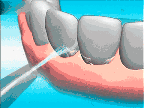 如何去除牙齿上的黑渍？牙医给你推荐几种有效办法
