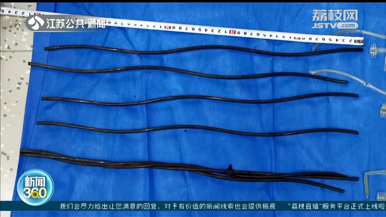 南京：7根钢筋贯穿男子胸腹，其中1根穿破心室 医护奋战7小时抢救