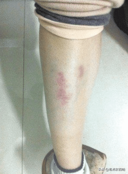 她演《李卫当官》红极一时，片场被打而淡出娱