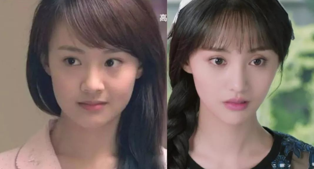 有人整容成功变仙女，也有人整容失败变惊悚，网友：云泥之别