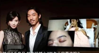 嫁到日本的林志玲，被爆遭老公家暴？幸福婚姻成泡沫