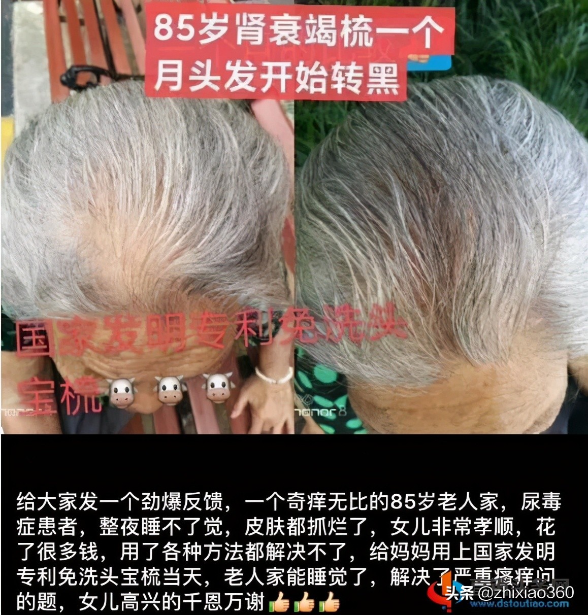 一把梳子能包治百病?涉嫌传销,东施帛关联公司被冻结资金2500万