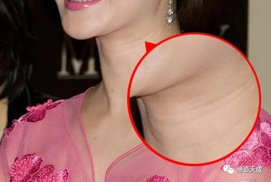 女人脖子有“三条杠”，你知道代表什么吗？