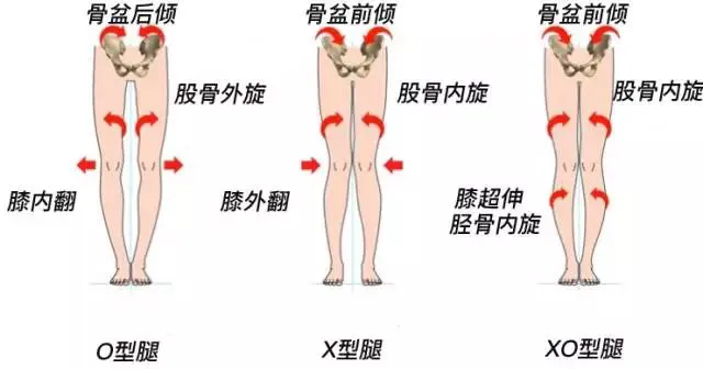 图文 林允儿的萝卜腿靠走外八能纠正 未必 2个动作轻松练成美人腿 林允儿的腿型矫正 Www Bagua5 Net