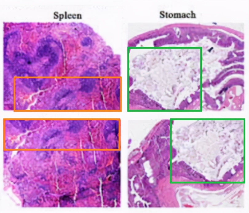 山东滨州医学院附属医院11篇SCI文章"挂榜"PubPeer