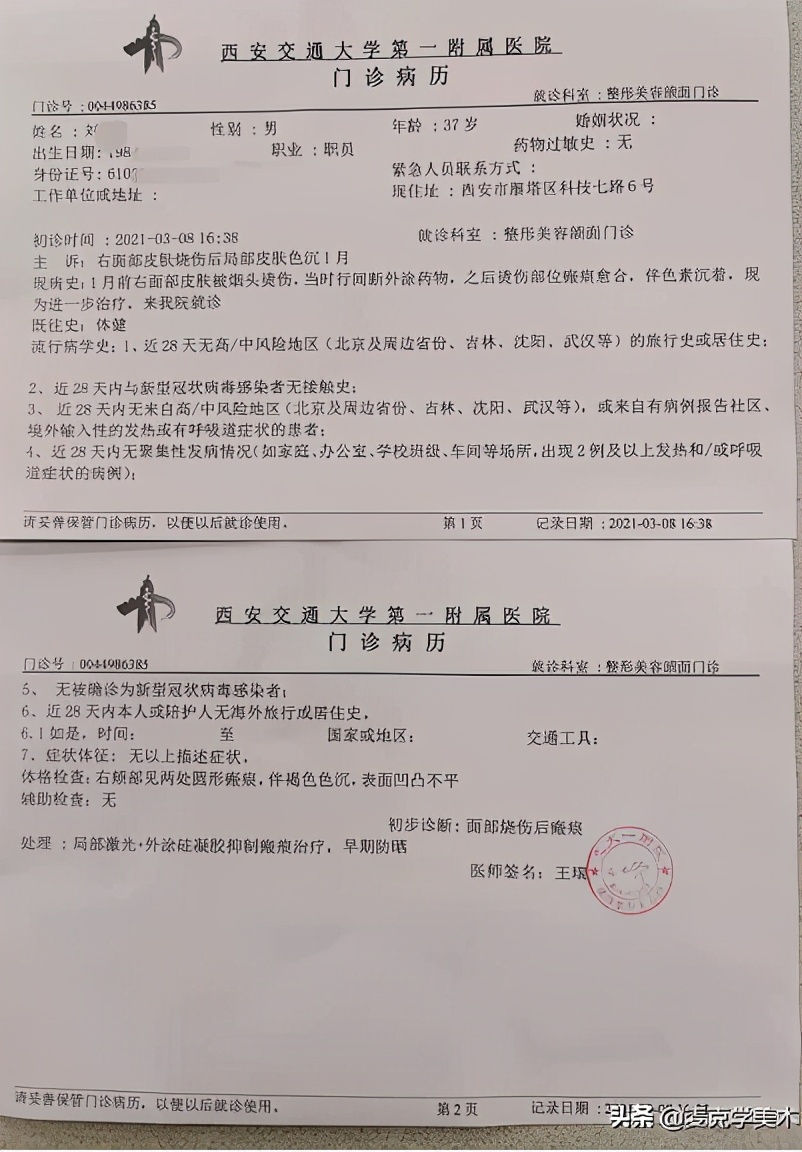 陕西烟头烫脸事件详情曝光西安警方通报职员遭高管烟头烫脸最新消息