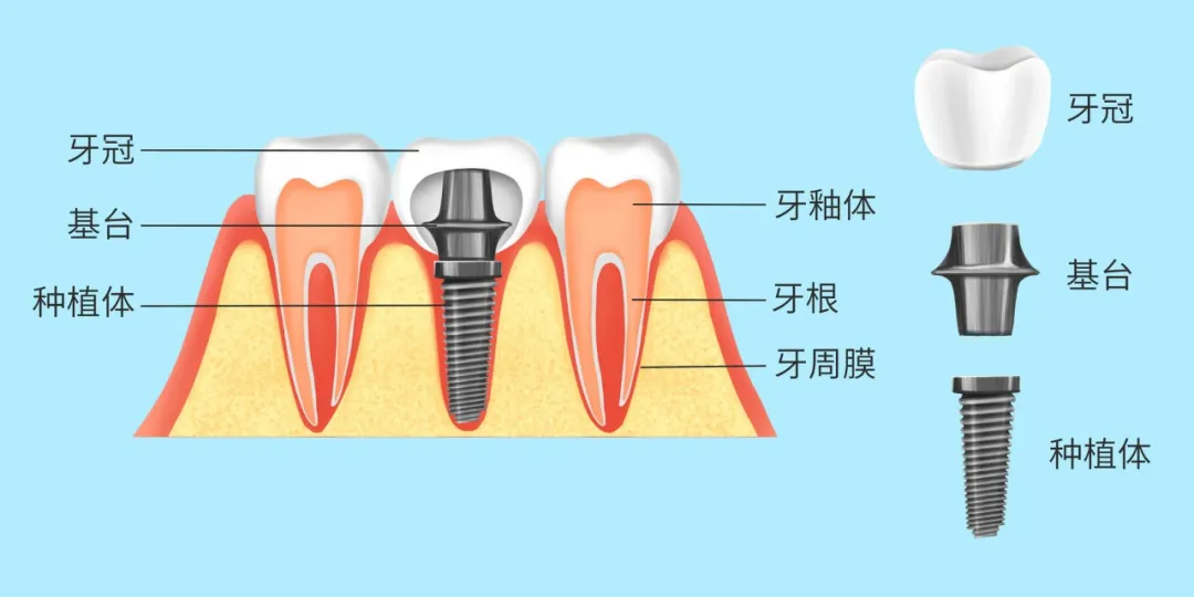 老年人如何做到科学饮食？一口好牙必不可少