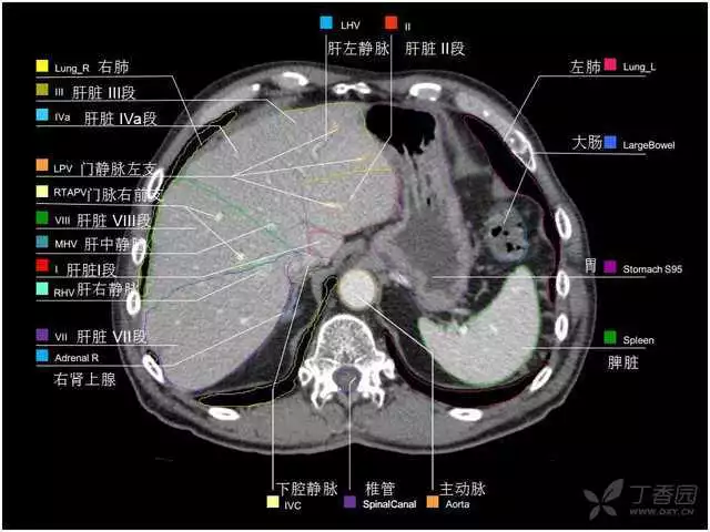 掌握这篇解剖，晋级腹部CT影像诊断高手（精细版）