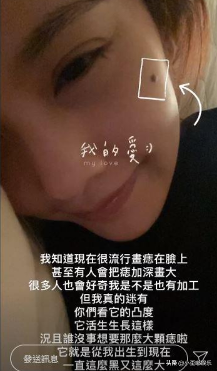 脸上有痣的女演员，位置长得恰到好处，非但不丑反而灵气逼人